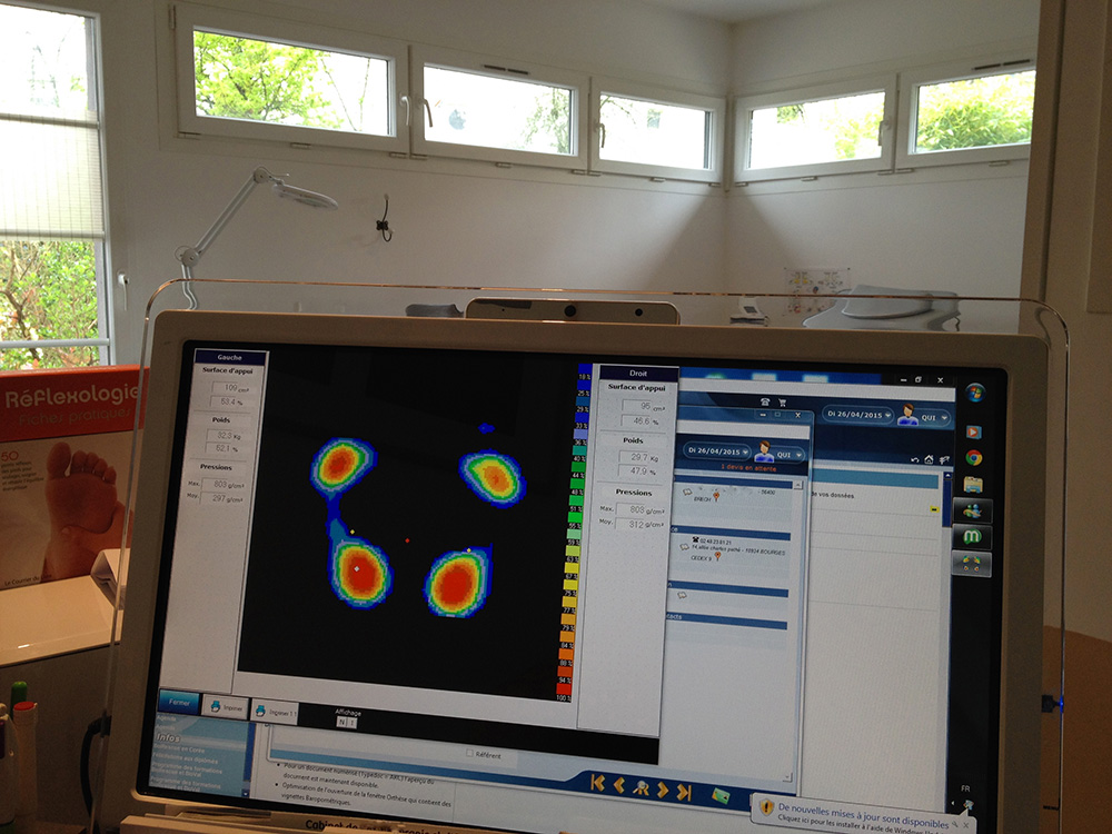 podologie analyse podometrique